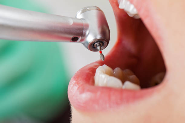 Best Broken or Cracked Tooth Emergency Dentist in Crooked River Ranch, OR